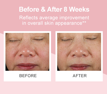 Before-and-after photos demonstrating improvement in overall skin appearance