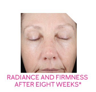Image of face after the eight-week retinization process with Mary Kay Clinical Solutions® Retinol 0.5 Set