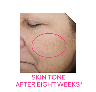 Image of cheek after the eight-week retinization process with Mary Kay Clinical Solutions® Retinol 0.5 Set